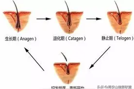 史上最全的日常防脱发指南图片