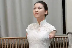 从断臂女孩到女明星，31岁雷庆瑶：你们用手做的事，我双脚都能做图片