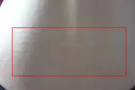 自我辨证：看看你的肾怎么样？图片