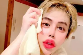 小伙被富婆相中，花一亿整成“蛇精男”，看到他17岁照片很迷惑图片