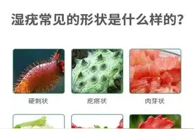 男性尖锐湿疣多可怕？网友：看完我性冷淡了！临床医生深度揭秘图片