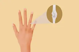 手指关节总是疼痛，和哪些原因有关？图片