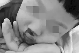 痛心！珠海3岁女童被火锅热汤从头浇下烫掉头皮！全身烫伤面积达8%！图片