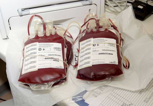 献血300cc是多少毫升图片,关于无偿献血的3点须知~有哪些益处?