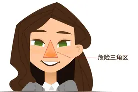 挤了一颗痘，竟要做开颅手术！医生提醒：这里的痘痘千万别挤图片