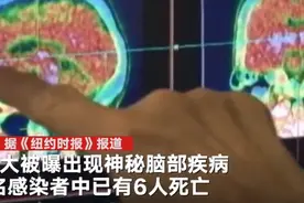 加拿大数十人感染“神秘疾病”致6人死亡：患者产生幻觉 出现认知障碍图片