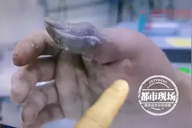 手指被扎出小孔没出血，8小时后却面临截肢！小心高压注射伤口图片