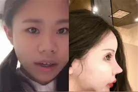 女孩3年整容60次，花费近百万却越整越丑，妈妈还很支持图片