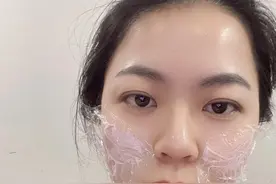 打嗨体熊猫针打出泪沟，三个月后我又溶解掉，现在是什么样子呢？图片