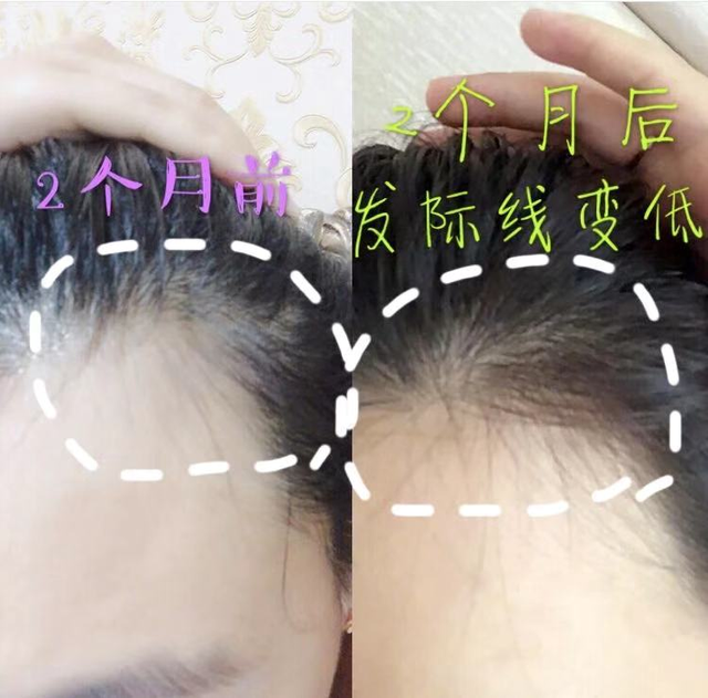 80后最爱的洗发水！“蜂花”再现江湖，上线3天就卖出了80000瓶