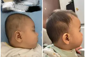 扁头真的好看吗？“平板电脑”似的后脑勺，可能悄悄影响宝宝智力图片