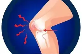 膝关节为什么疼痛？能治好吗？该如何应对呢？给您详细讲清楚图片