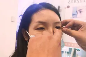 眼窝凹陷是什么引起的呢？视频封面