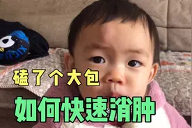 嘟嘟儿头被磕了个大乌包，妈妈心疼几秒后快速处理，三个小时消肿