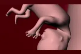 孕妇怀上五胞胎，肚皮被撑得几近透明，真担心会被“撑破”！