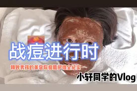 战痘大片 | 精致男孩的美容院痘肌护理全纪实，针清太疼了视频封面