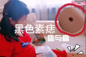 宝宝小腿长黑痣，面积变大颜色深，9岁必须做手术，啥痣这么严重