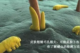 皮肤粗糙毛孔粗大可能是脸上有虫，你了解螨虫的检测方法吗？