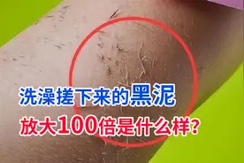 洗澡搓下来的黑泥到底是什么？显微镜放大100倍，看完一阵恶寒视频封面