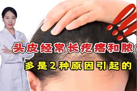 头皮经常长疙瘩和脓包？提醒：多是2种原因引起的，医生教你改善视频封面