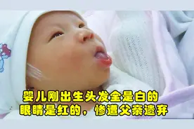 婴儿刚出生头发全是白的，眼睛是红的，惨遭父亲遗弃《弃婴病房》视频封面