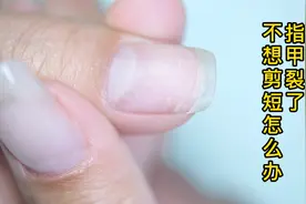 指甲裂了不想剪怎么办？视频封面
