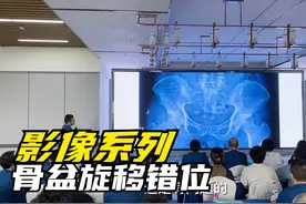 MR，CT ，X光看片教程：通过X光影像判断骨盆旋转错位的方法视频封面