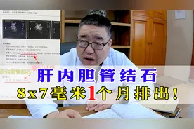 肝内胆管结石，8x7mm，吃中药1个月后怎样了？