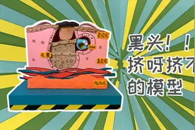 挤挤挤真的能把黑头去掉？挤出来的白色物体又是什么呢？视频封面