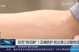 如何防范春季“桃花癣”？医生：及时清洗暴露部位，严重时需就医视频封面