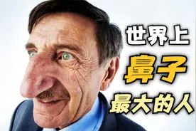 8.8cm！土耳其男子蝉联世界鼻子最大的人视频封面