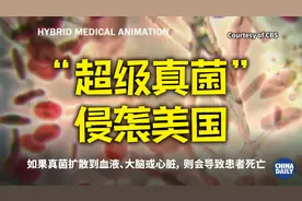 “超级真菌”侵袭美国医疗机构  百余人感染 3人死亡