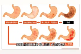 3药增强胃黏膜屏障，抗炎抗氧化，促进胃溃疡愈合，消除腹痛癌变视频封面