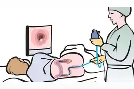 超过这个大小的结肠息肉，肠镜切除无法胜任，治疗就得多“受罪”