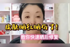 皮肤晒红晒伤了不用怕，教你省钱快速晒后修复，退红镇静预防晒斑视频封面
