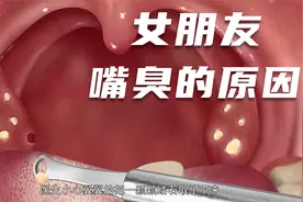 我和女朋友接吻 发现她的嘴很臭视频封面
