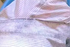 衣服上有霉斑不用愁，用这种水泡一泡，霉斑轻松去除干净，快学学视频封面