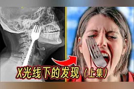 肛门里的灯泡？20个在x光线下发现的奇怪物体（上集）视频封面