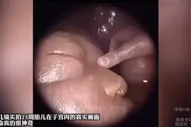 胎儿镜实拍25周胎儿在子宫内的真实画面，生命真的很神奇视频封面