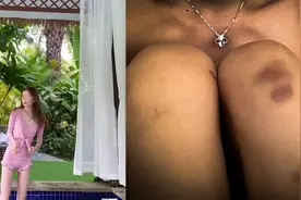 自曝在马尔代夫遭性侵中国女生发声：酒店已道歉，警方未控制嫌犯视频封面