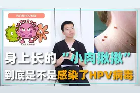 身上长了“小肉揪揪”，到底是不是感染了HPV病毒？医生为你解答视频封面