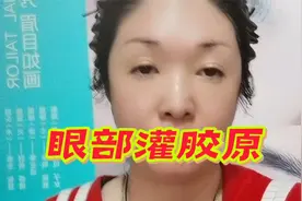 眼部护理新突破：给眼部灌胶原，一周淡化眼袋眼纹，年轻3～5岁