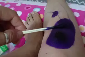 化脓的伤口就用这个方法处理 ，不超过十块钱 ，我正在体验中。视频封面