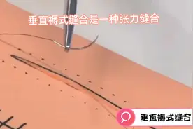 外科医生进行垂直褥式缝合演示，适合张力大，皮肤松弛的伤口！视频封面
