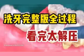 洗牙完整版全过程！看完太解压了！