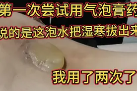 腰间盘还有点后遗症，用了起泡膏药，鼓出一个很大的水泡。处理视频封面