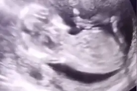 你看到的宝宝在肚子里打嗝VS实际上宝宝打嗝视频封面