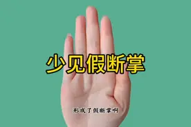 少见的假断掌有什么特征？