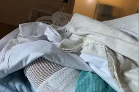 烧伤是等级最高的疼痛，保罗描述一下是什么感觉，哈哈哈😆视频封面