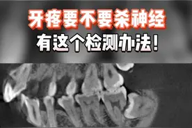 牙疼要不要杀神经，有这个检测办法！#牙齿视频封面